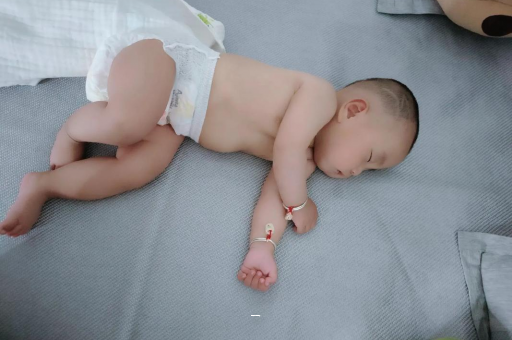 漯河宝宝脸上有白色斑块 漯河宝宝脸上有白色斑块